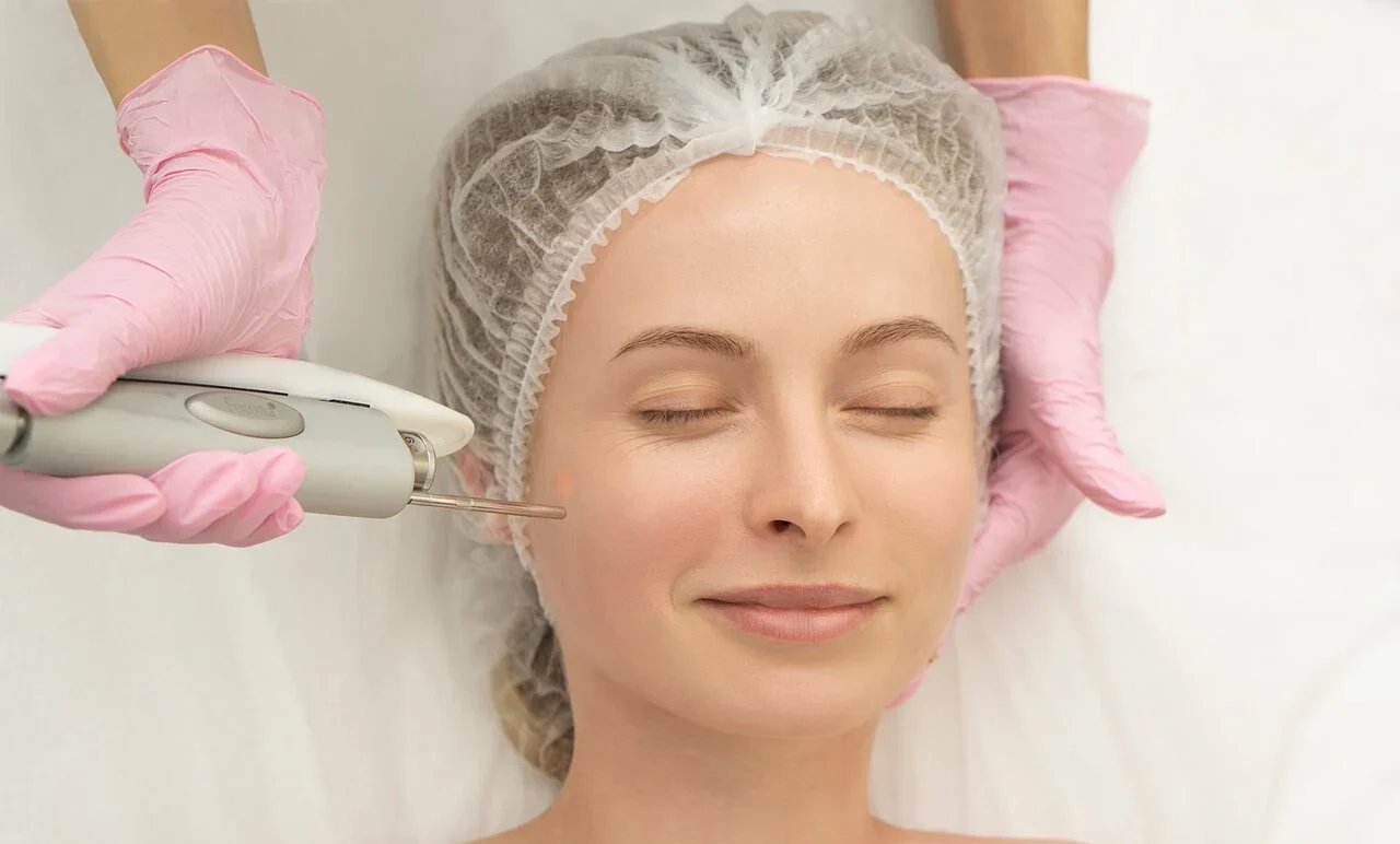 Fotona laser - Divulgação